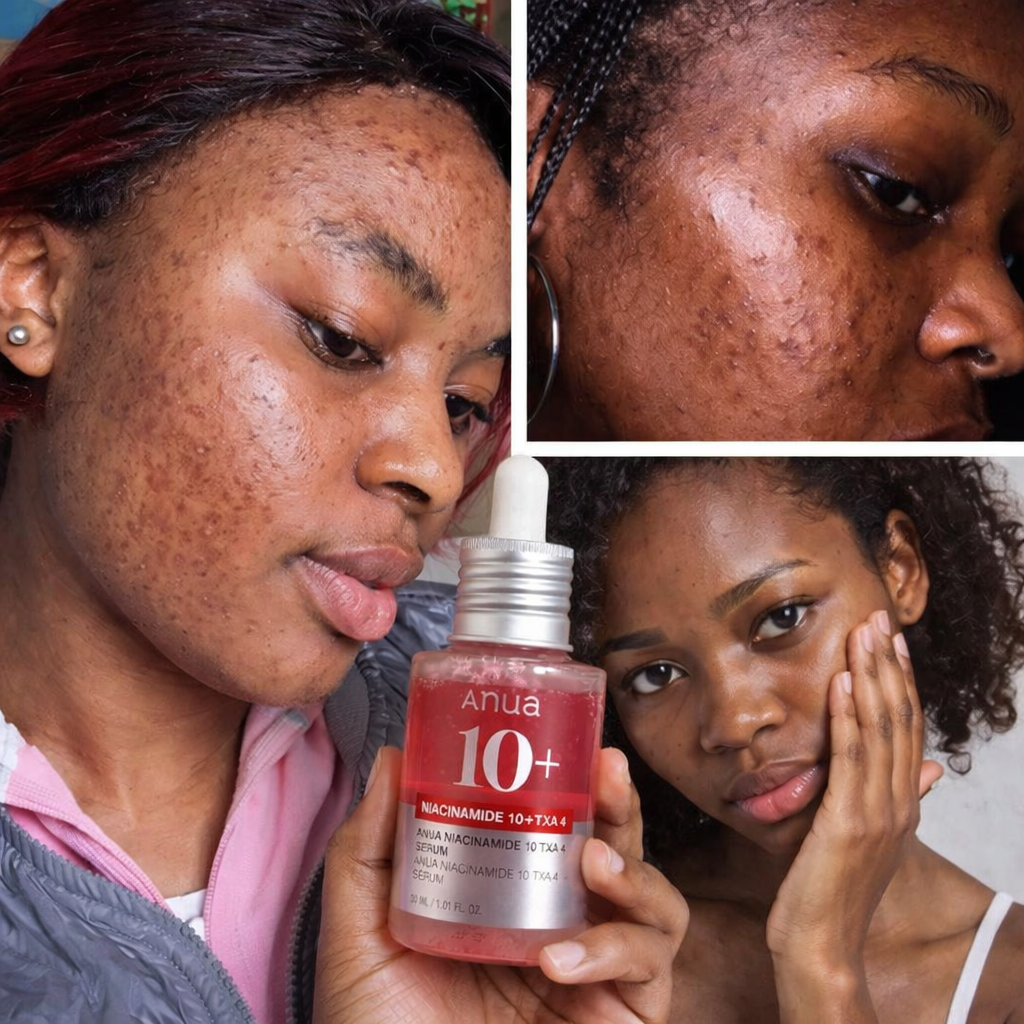 Adieu aux Taches et boutons! Découvrez le Sérum Anua 10% Niacinamide