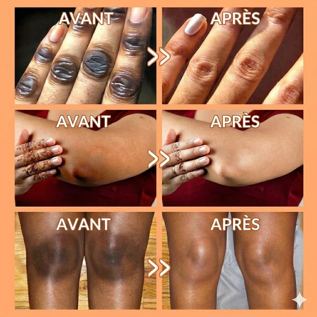 Adieu aux Taches et boutons! Découvrez le Sérum Anua 10% Niacinamide